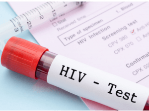 Проект «Впровадження гібридної моделі тестування на ВІЛ у Полтавській області»