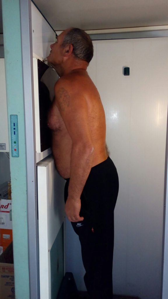 У Великобагачанському районі працює виїздний  флюорограф