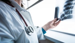 ЯК НЕ СПЛУТАТИ COVID-19 З ТУБЕРКУЛЬОЗОМ